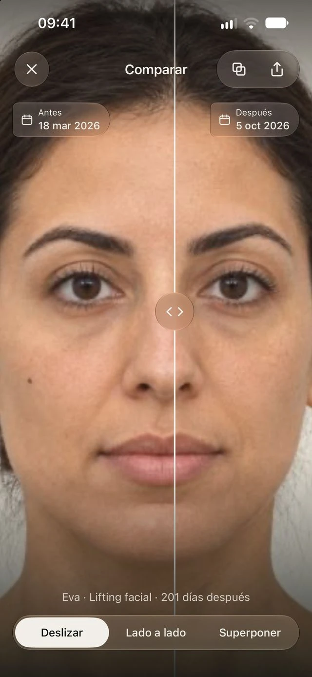 Comparación ilustrativa de antes y después en DrPhoto con divisor deslizante y fechas de las fotos