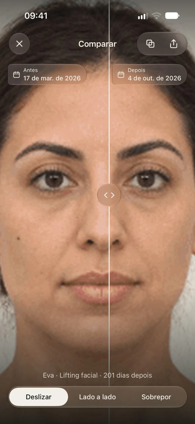 Comparação ilustrativa de antes e depois na DrPhoto com divisor deslizante e datas das fotos