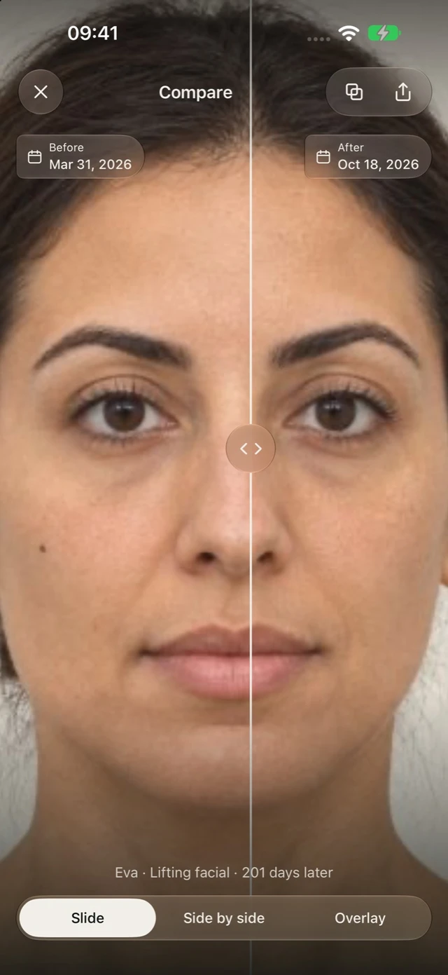 Illustrative before-and-after comparison in DrPhoto with a sliding divider and photo dates