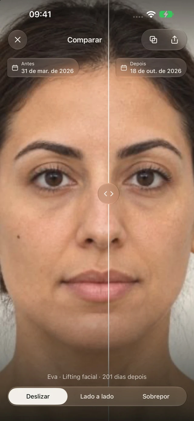 Comparação ilustrativa de antes e depois na DrPhoto com divisor deslizante e datas das fotografias