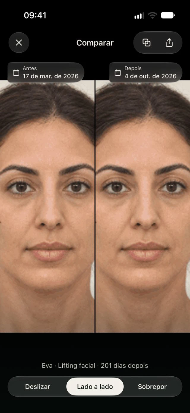 Comparação ilustrativa na DrPhoto com duas fotos lado a lado e suas datas