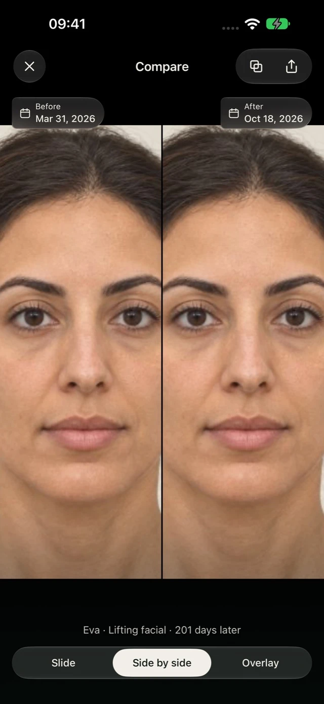 Illustrative comparison in DrPhoto with two photos side by side and their dates