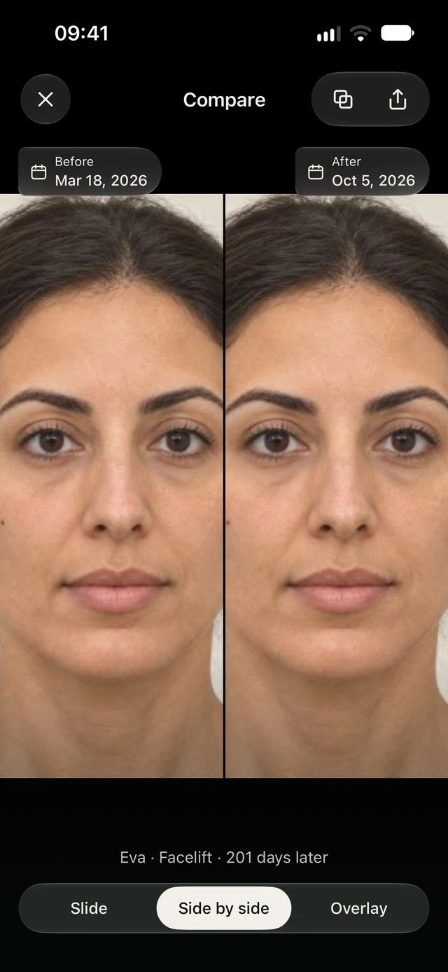 Illustrative comparison in DrPhoto with two photos side by side and their dates