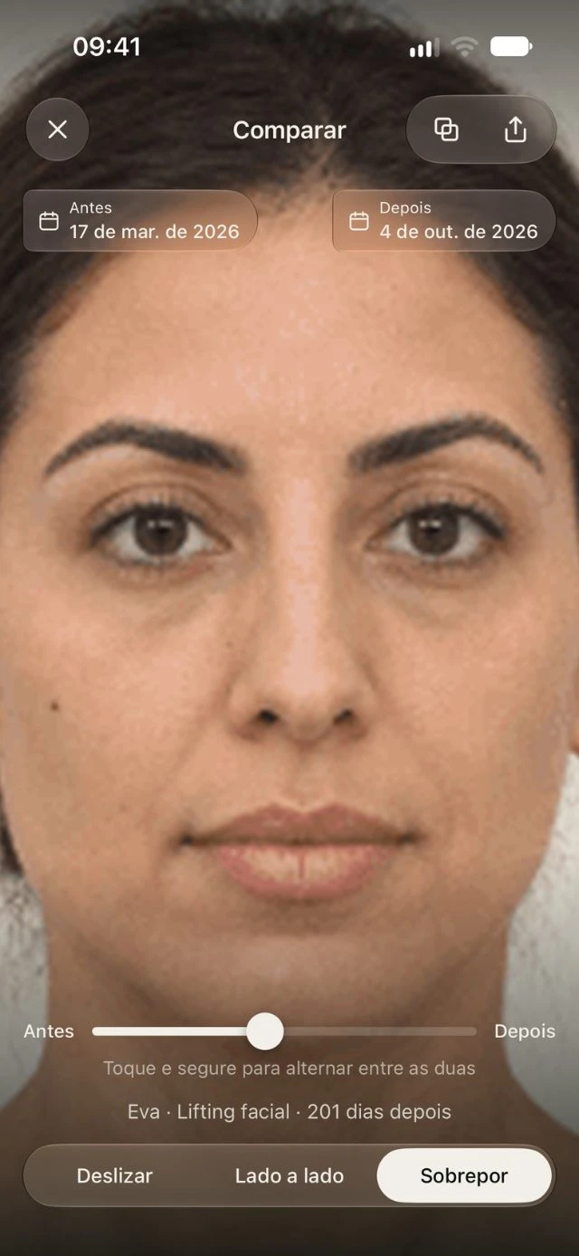 Comparação ilustrativa na DrPhoto com fotos sobrepostas e controle para alternar entre antes e depois