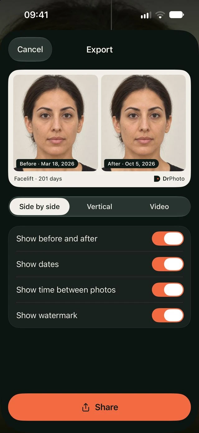Comparison export in DrPhoto with options for format, dates, time between photos and watermark