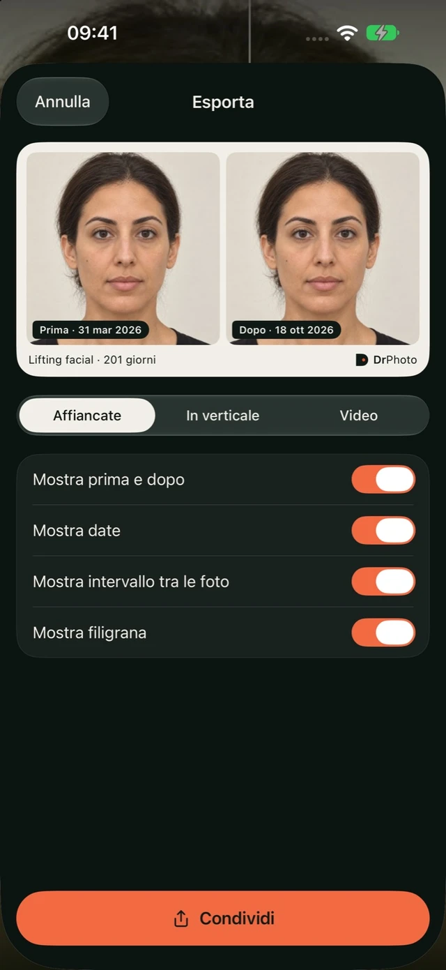 Esportazione del confronto in DrPhoto con formato, date, intervallo e filigrana