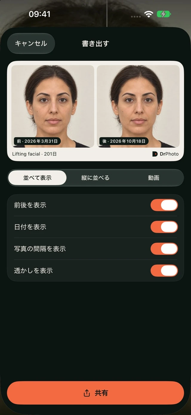 形式、日付、撮影間隔、透かしを設定するDrPhotoの比較書き出し
