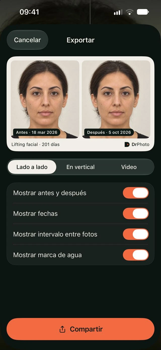 Exportación de comparación en DrPhoto con opciones de formato, fechas, intervalo entre fotos y marca de agua