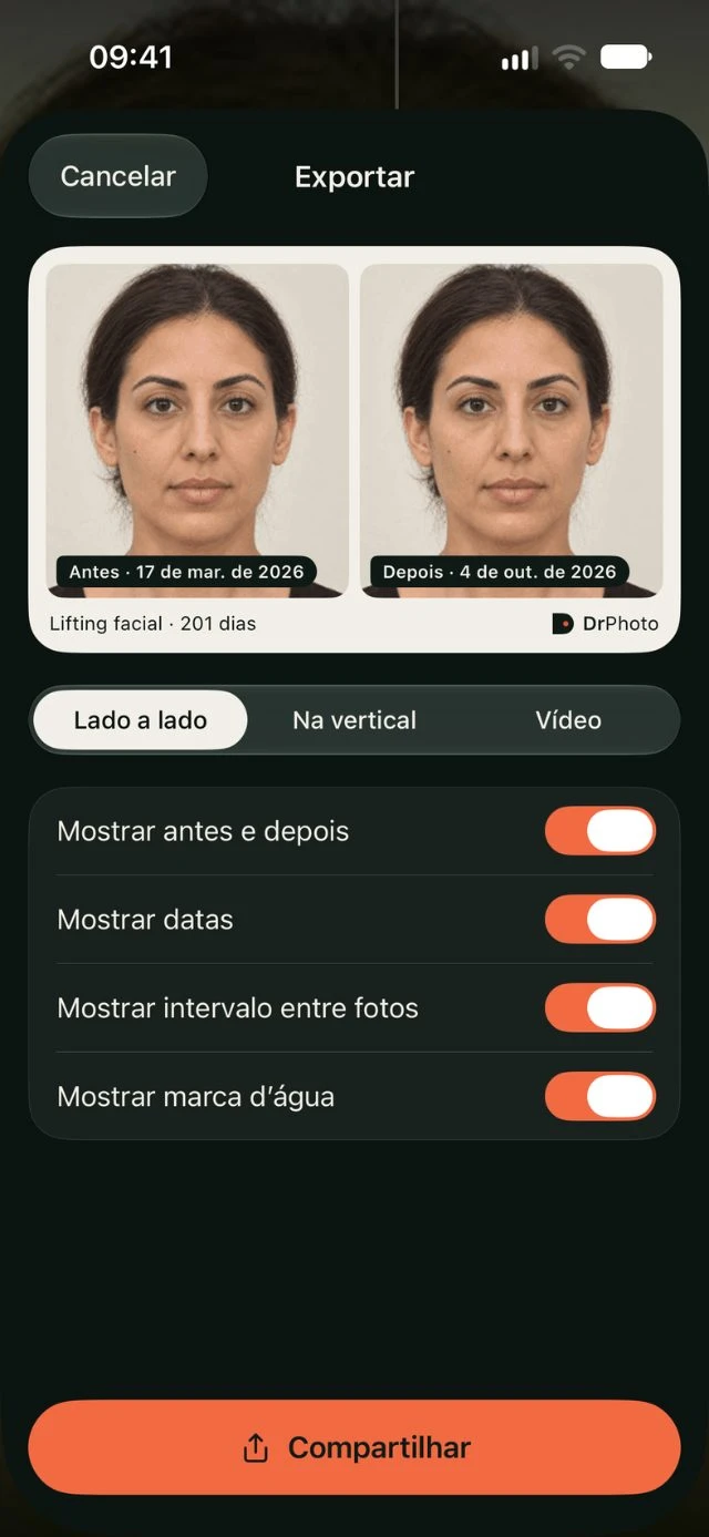 Exportação de comparação na DrPhoto com opções de formato, datas, intervalo entre fotos e marca d’água