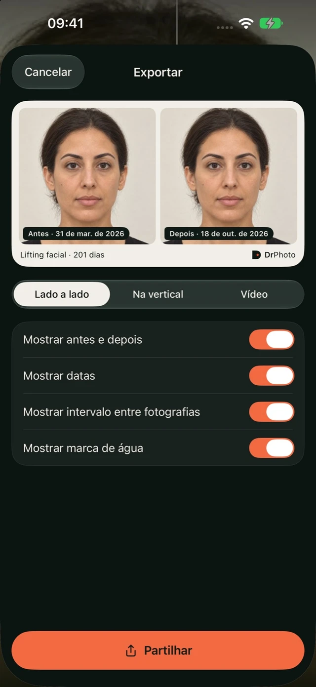 Exportação de comparação no DrPhoto com formato, datas, intervalo entre fotografias e marca de água