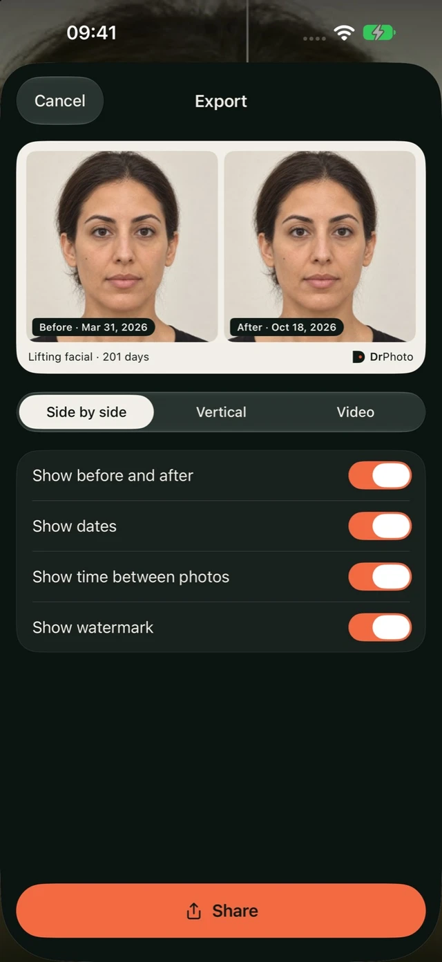 Comparison export in DrPhoto with options for format, dates, time between photos and watermark
